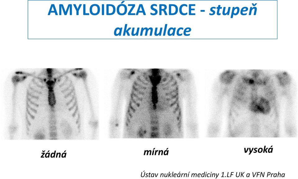 vysoká Ústav nukleární