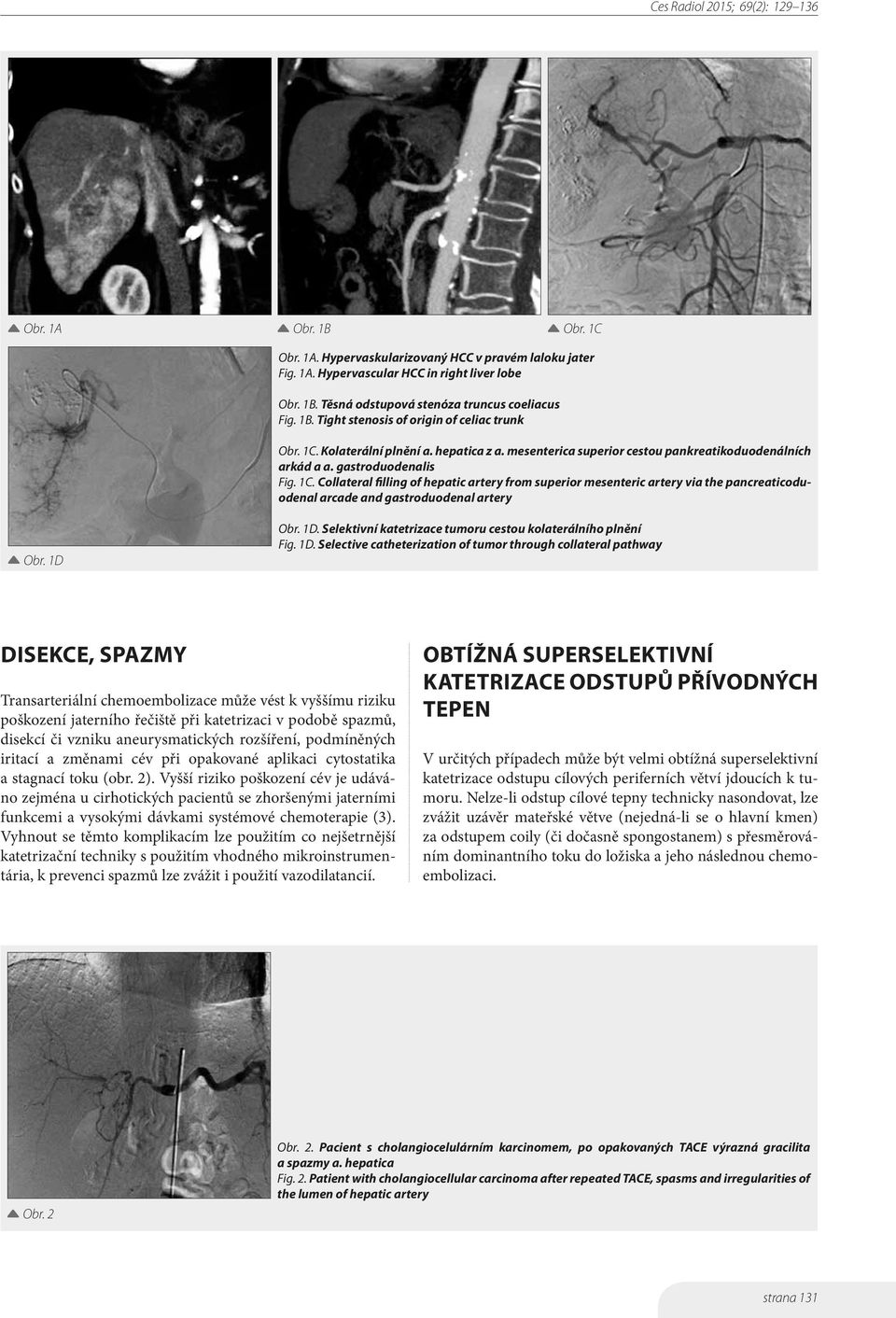 Collateral filling of hepatic artery from superior mesenteric artery via the pancreaticoduodenal arcade and gastroduodenal artery Obr. 1D 