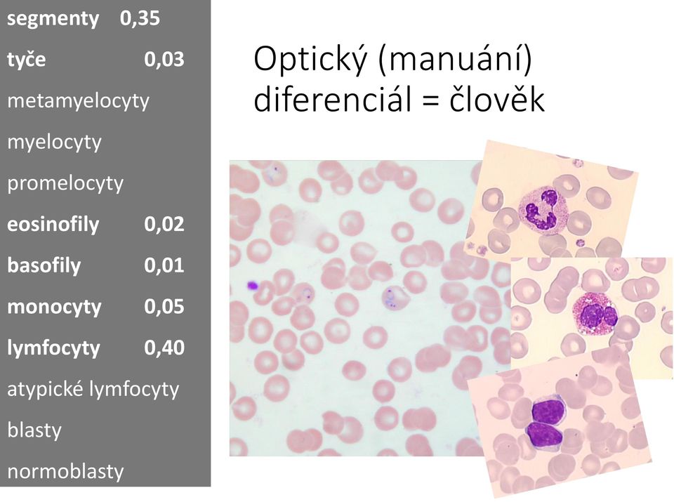 monocyty 0,05 lymfocyty 0,40 atypické lymfocyty