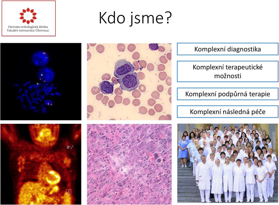 terapeutické možnosti Komplexní