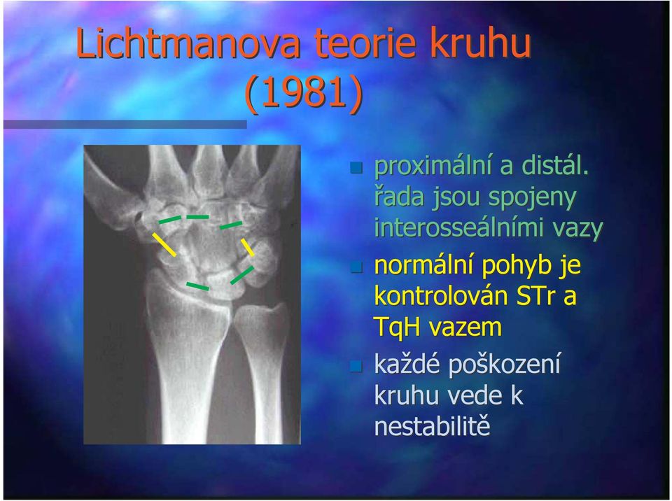 řada jsou spojeny interosseálními vazy