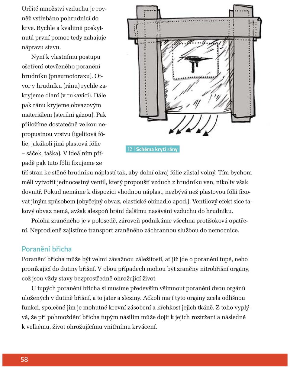 Pak přiložíme dostatečně velkou nepropustnou vrstvu (igelitová fólie, jakákoli jiná plastová fólie 12 Schéma krytí rány sáček, taška).