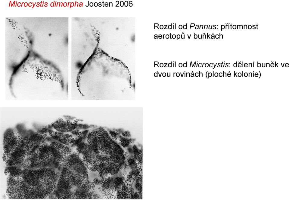 v buňkách Rozdíl od Microcystis: