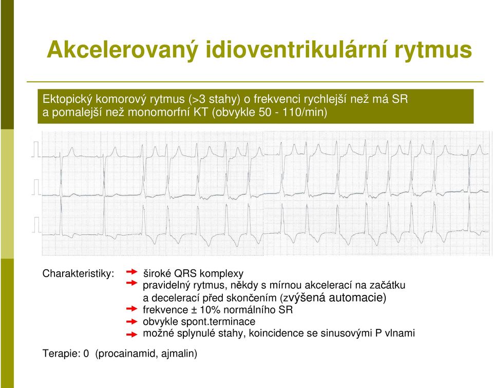 s mírnou akcelerací na začátku a decelerací před skončením (zvýšená automacie) frekvence ± 10% normálního SR