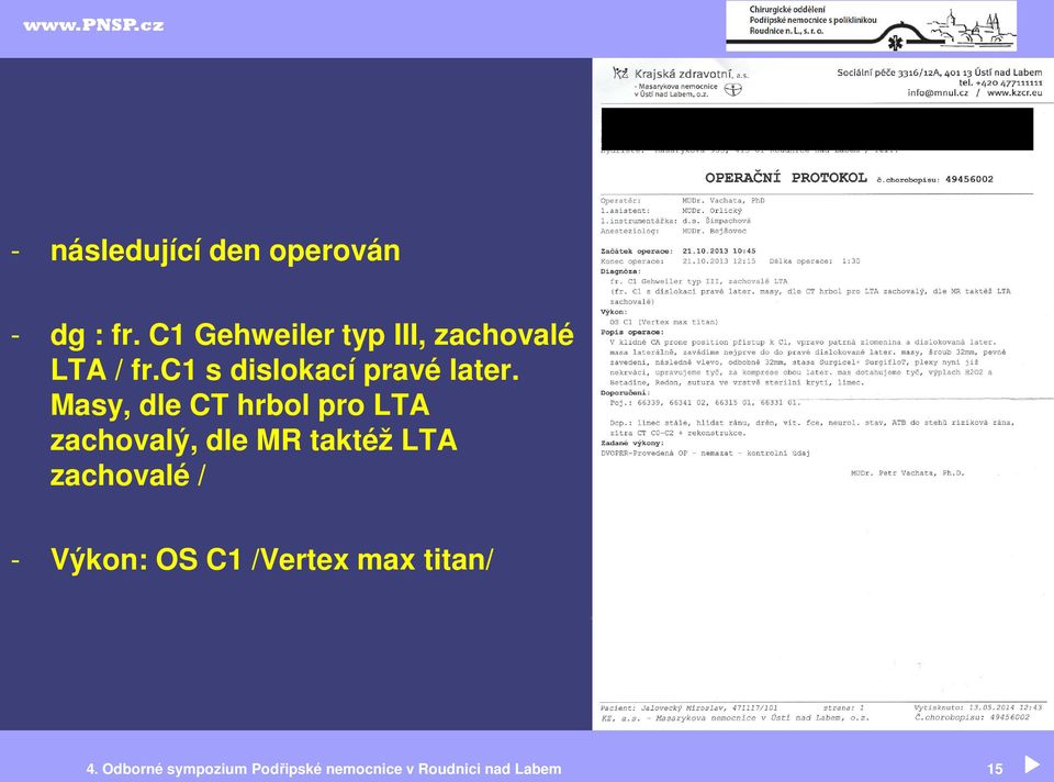 Masy, dle CT hrbol pro LTA zachovalý, dle MR taktéž LTA zachovalé /