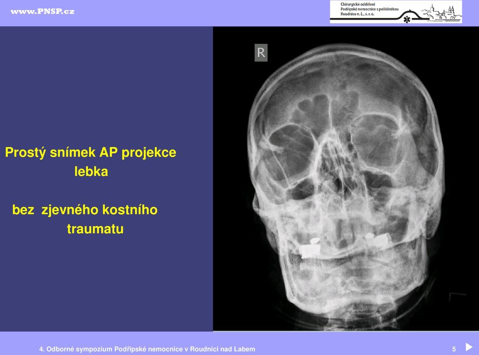 4. Odborné sympozium Podřipské