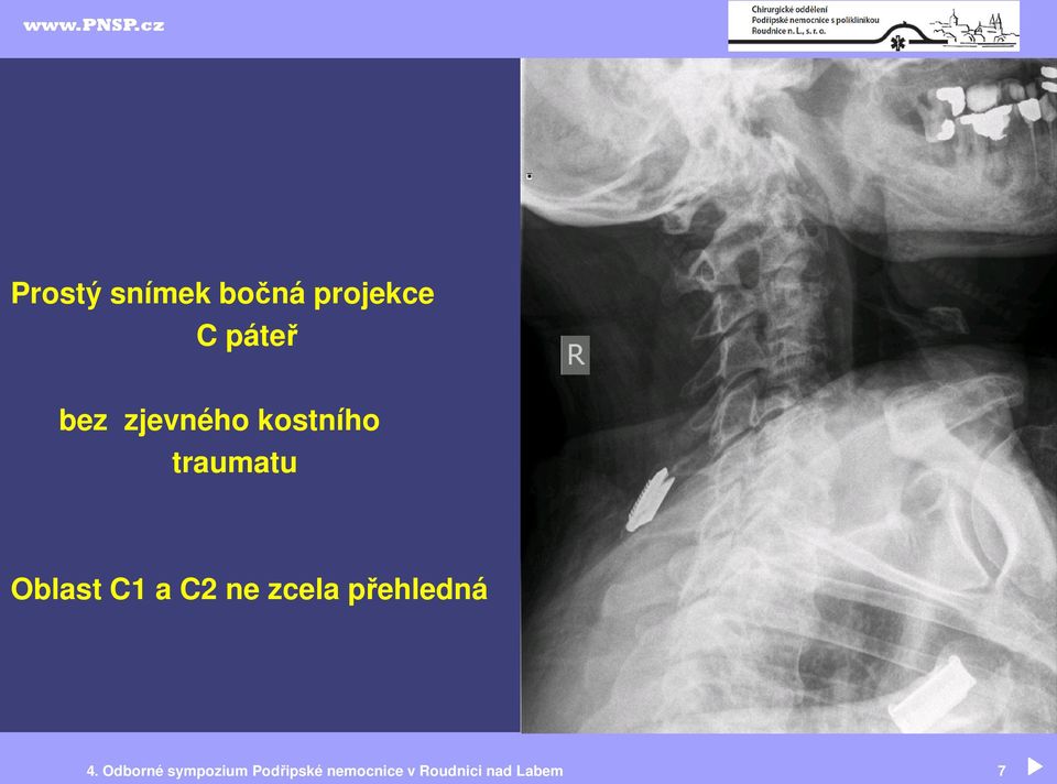 ne zcela přehledná 4.