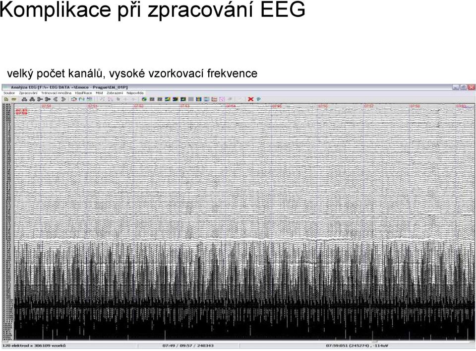 velký počet kanálů,