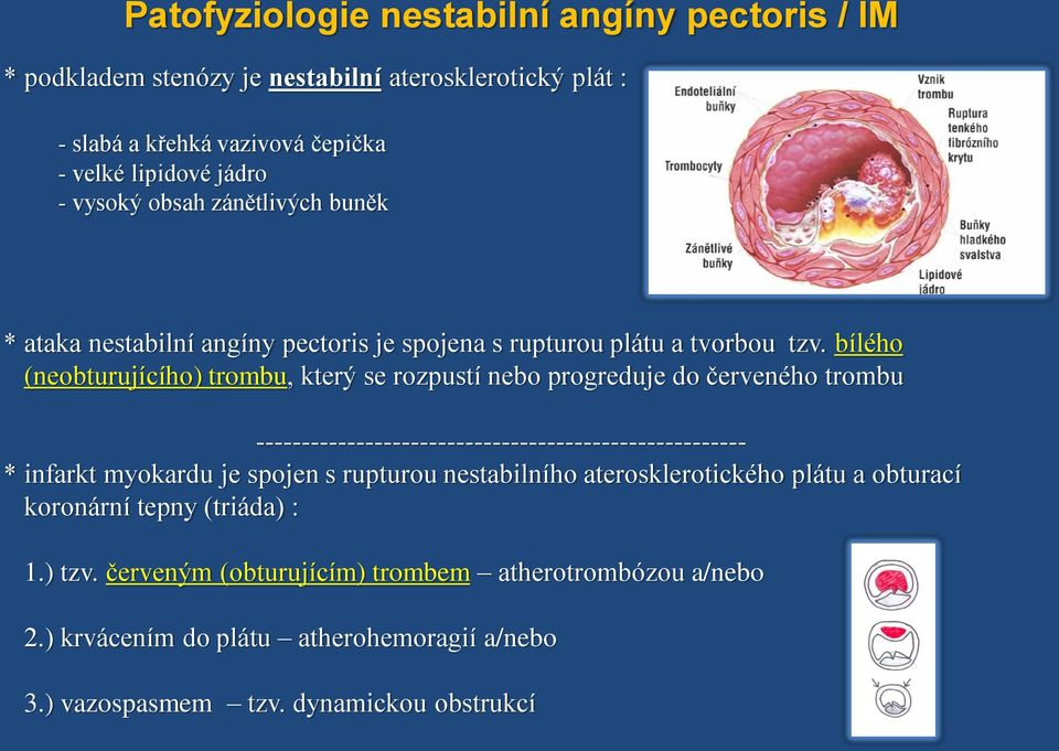 bílého (neobturujícího) trombu, který se rozpustí nebo progreduje do červeného trombu ------------------------------------------------------ * infarkt myokardu je spojen