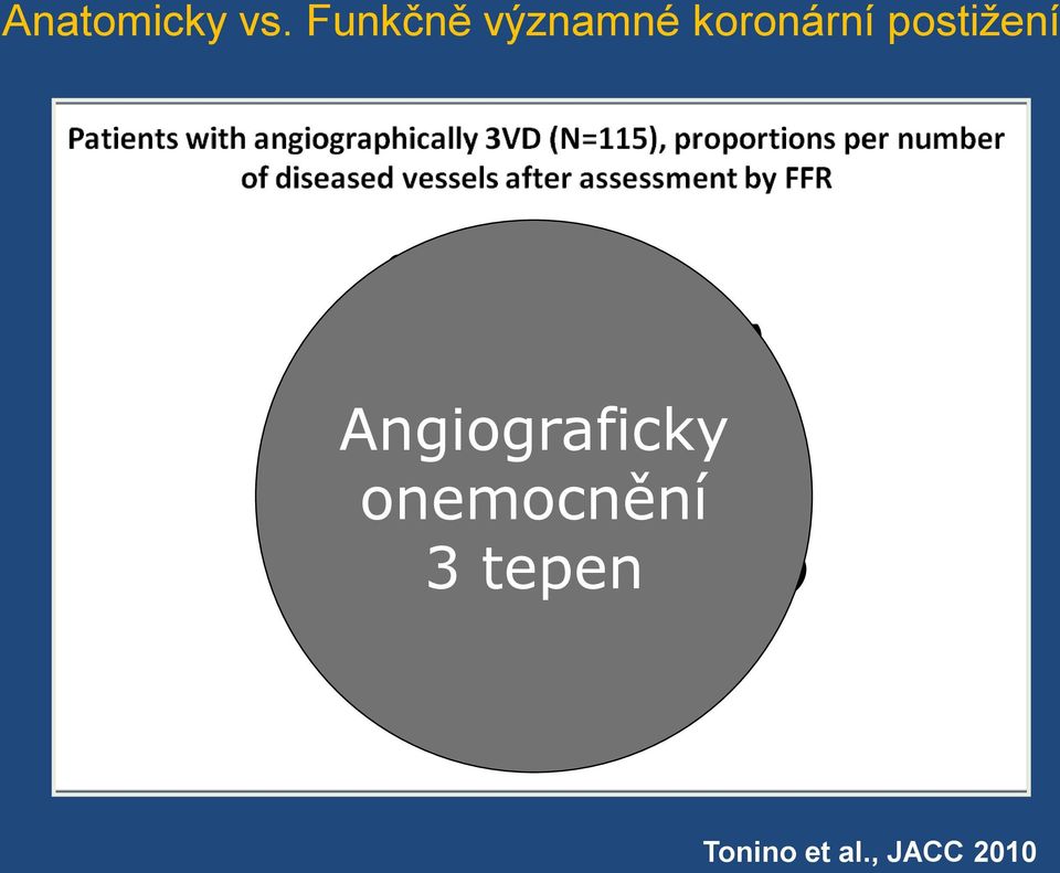 0VD (9%) 3VD (14%) Angiograficky