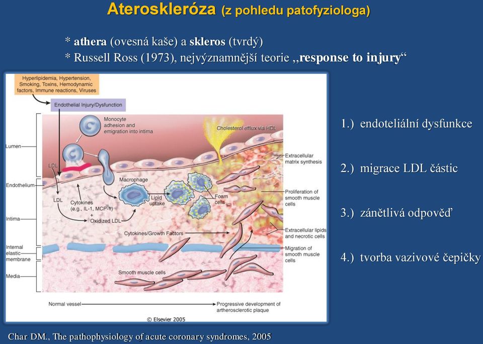 ) endoteliální dysfunkce 2.) migrace LDL částic 3.) zánětlivá odpověď 4.