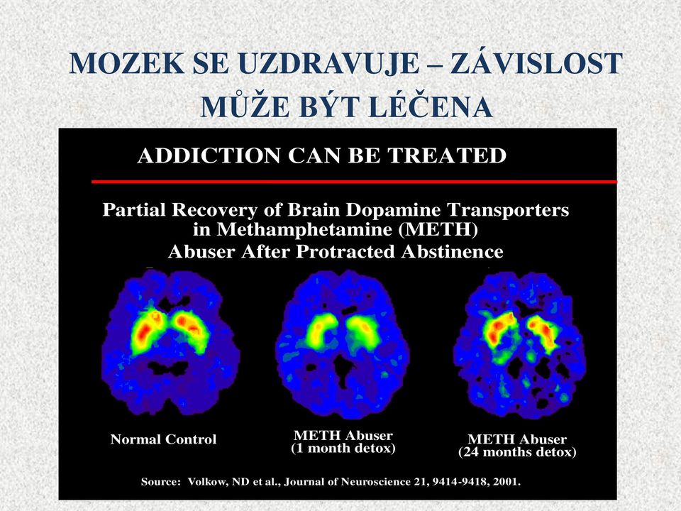 Protracted Abstinence Normal Control METH Abuser (1 month detox) METH Abuser (24