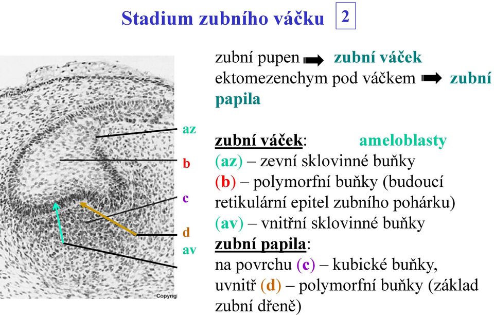 buňky (budoucí retikulární epitel zubního pohárku) (av) vnitřní sklovinné buňky