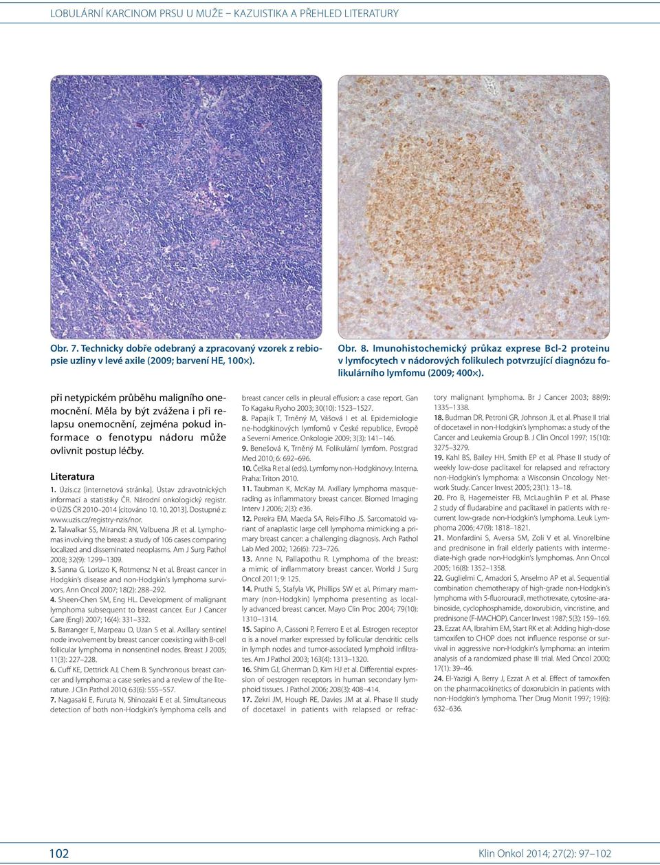 Gan To Kagaku Ryoho 2003; 30(10): 1523 1527. 8. Papajík T, Trněný M, Vášová I et al. Epidemiologie ne hodgkinových lymfomů v České republice, Evropě a Severní Americe. Onkologie 2009; 3(3): 141 146.