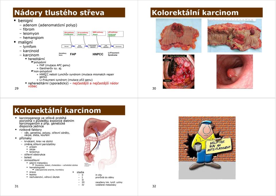 karcinom 30 Kolorektální karcinom karcinogeneze ve střevě probíhá pozvolna v důsledku expozice dietním karcinogenům a příp.