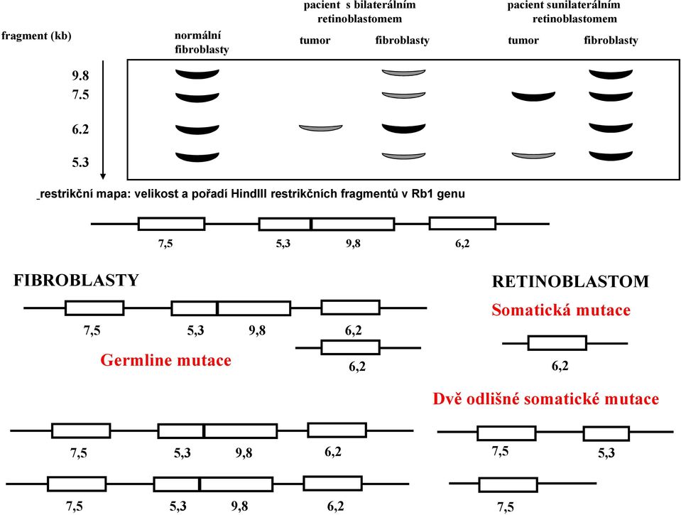 3 restrikční mapa: velikost a pořadí HindIII restrikčních fragmentů v Rb1 genu 7,5 5,3 9,8 FIBROBLASTY