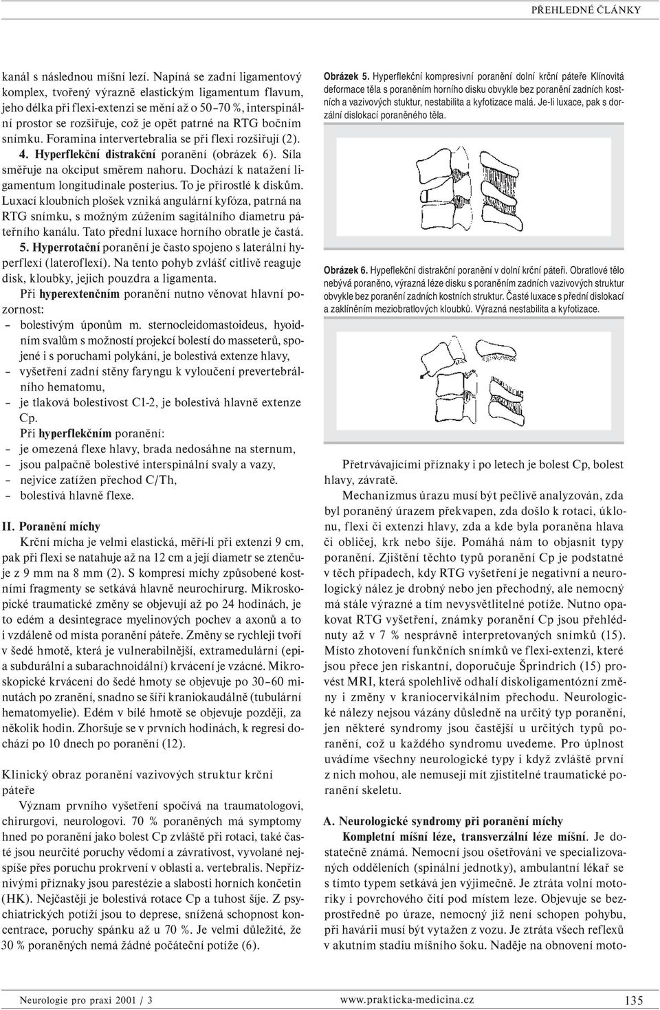 bočním snímku. Foramina intervertebralia se při flexi rozšiřují (2). 4. Hyperflekční distrakční poranění (obrázek 6). Síla směřuje na okciput směrem nahoru.