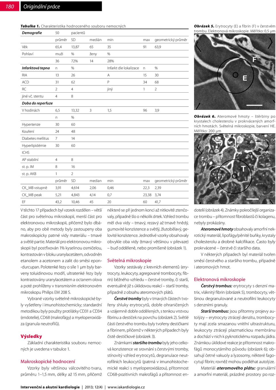 Infarkt dle lokalizace n % RIA 13 26 A 15 30 ACD 31 62 P 34 68 RC 2 4 jiný 1 2 jiné vč.