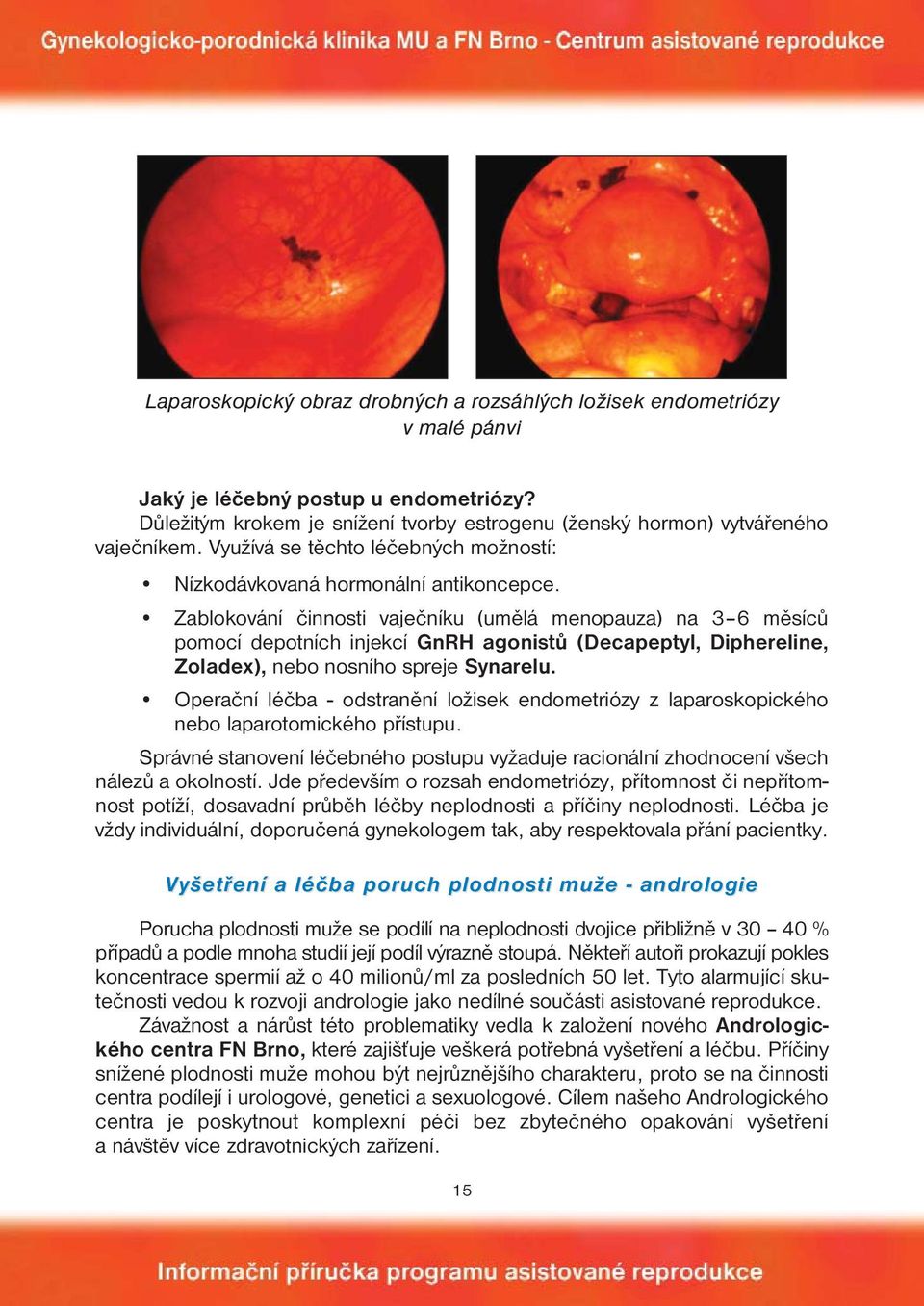 Zablokování činnosti vaječníku (umělá menopauza) na 3 6 měsíců pomocí depotních injekcí GnRH agonistů (Decapeptyl, Diphereline, Zoladex), nebo nosního spreje Synarelu.