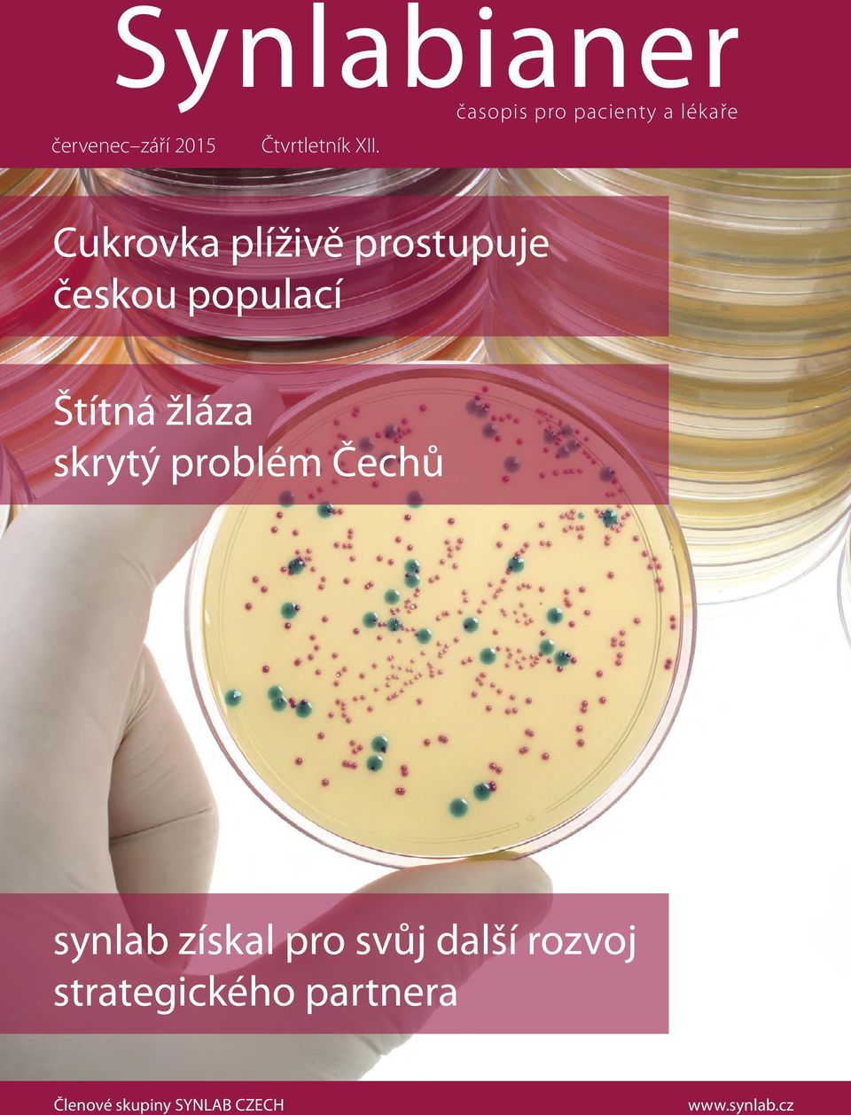 populací Štítná žláza skrytý problém Čechů synlab získal pro