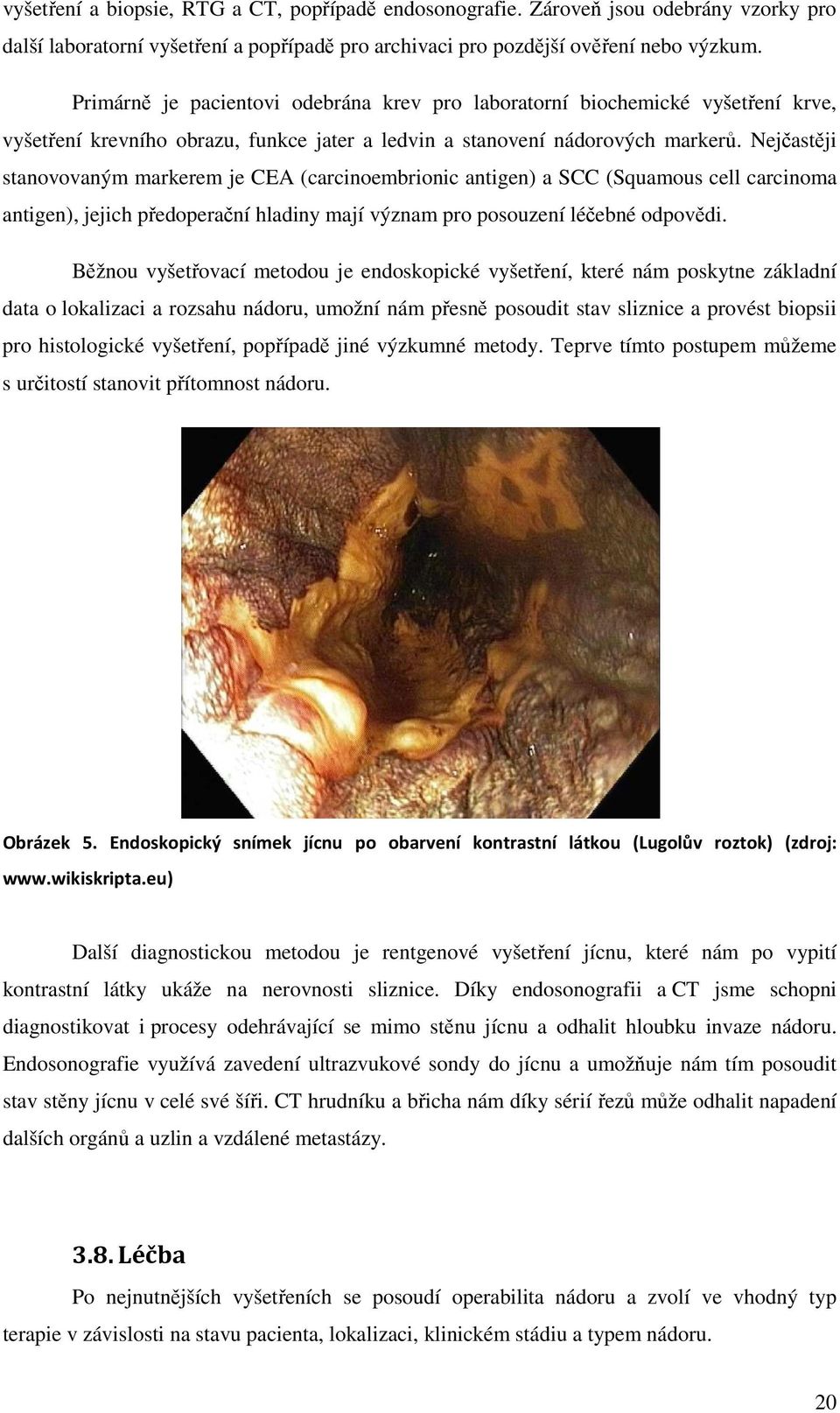 Nejčastěji stanovovaným markerem je CEA (carcinoembrionic antigen) a SCC (Squamous cell carcinoma antigen), jejich předoperační hladiny mají význam pro posouzení léčebné odpovědi.