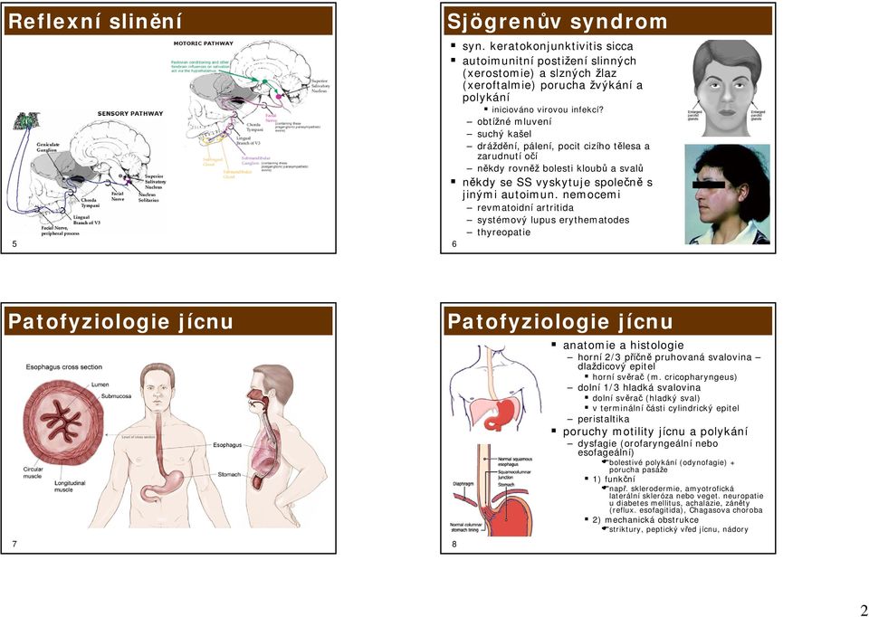 nemocemi revmatoidní artritida systémový lupus erythematodes 6 thyreopatie Patofyziologie jícnu 7 Patofyziologie jícnu anatomie a histologie horní 2/3 příčně pruhovaná svalovina dlaždicový epitel