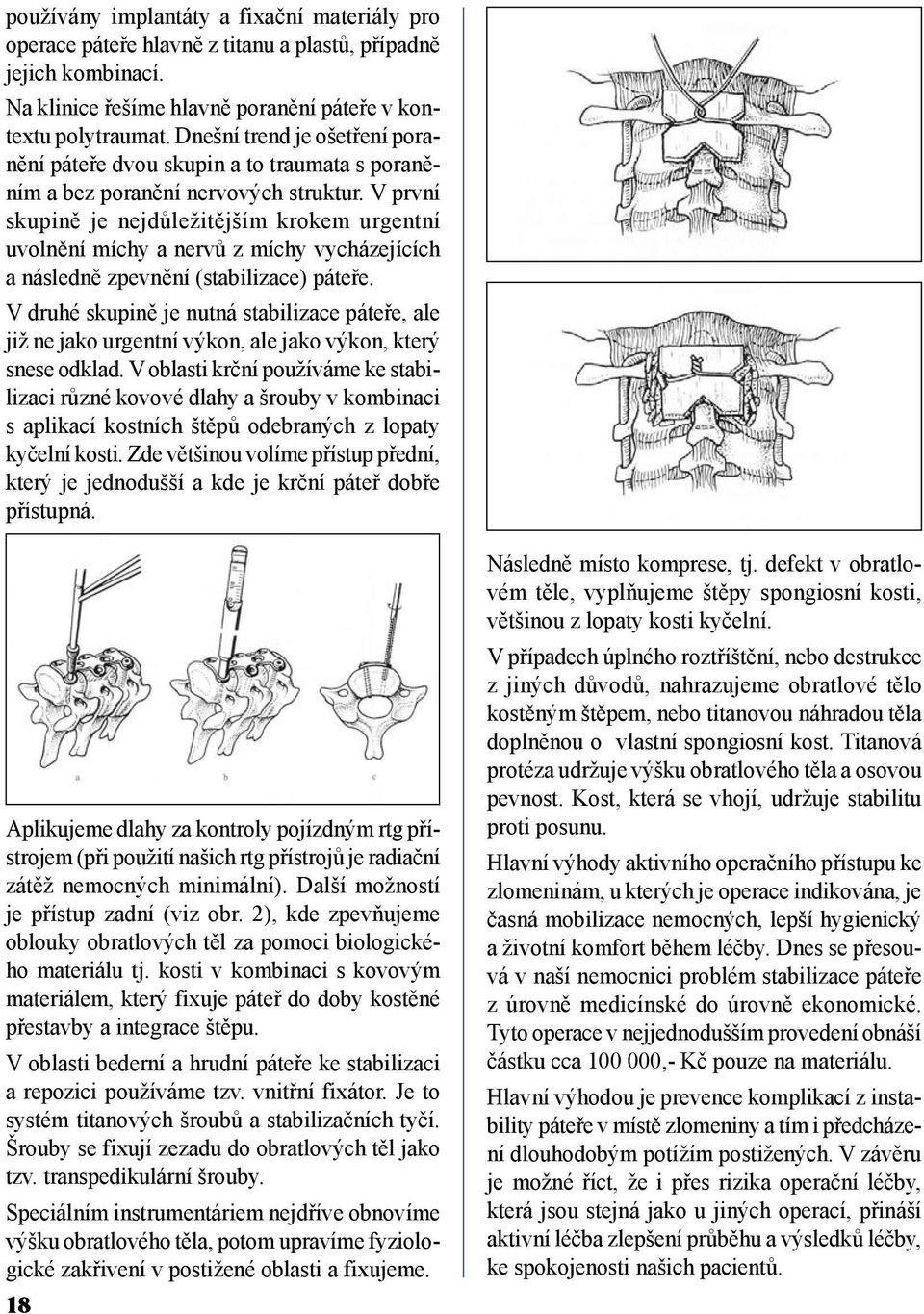 V první skupině je nejdůležitějším krokem urgentní uvolnění míchy a nervů z míchy vycházejících a následně zpevnění (stabilizace) páteře.