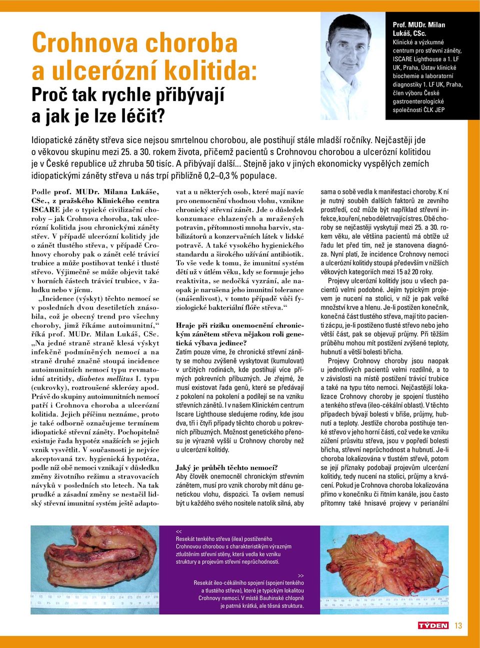 LF UK, Praha, člen výboru České gastroenterologické společnosti ČLK JEP Idiopatické záněty střeva sice nejsou smrtelnou chorobou, ale postihují stále mladší ročníky.