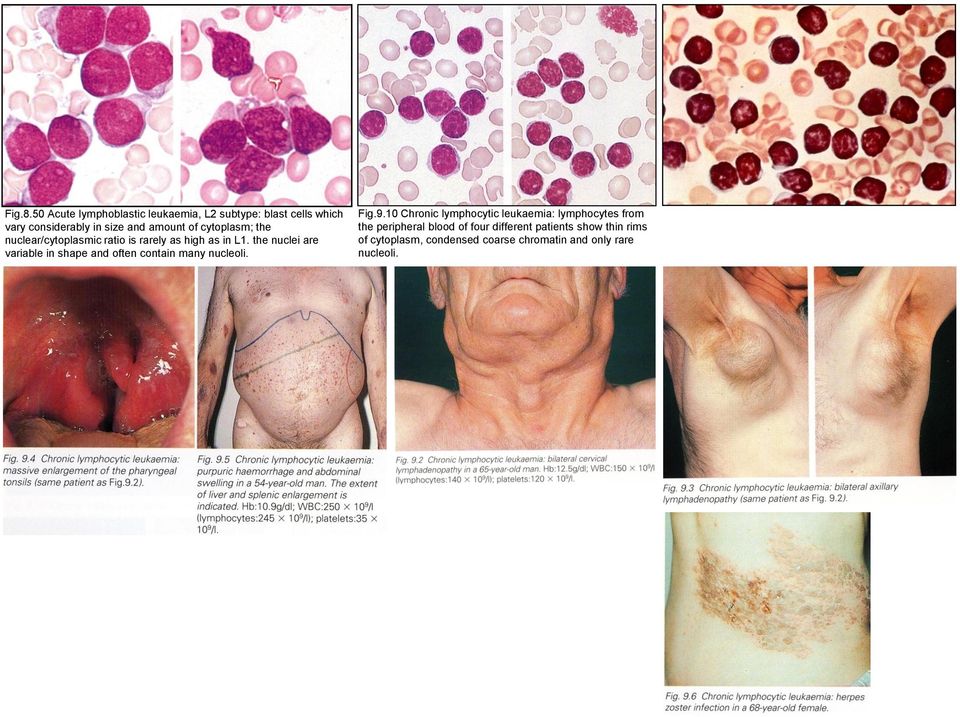 cytoplasm; the nuclear/cytoplasmic ratio is rarely as high as in L1.