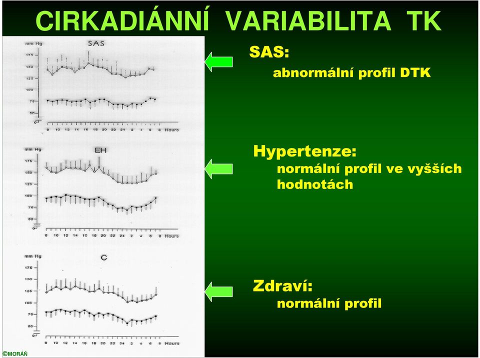 Hypertenze: normální profil ve