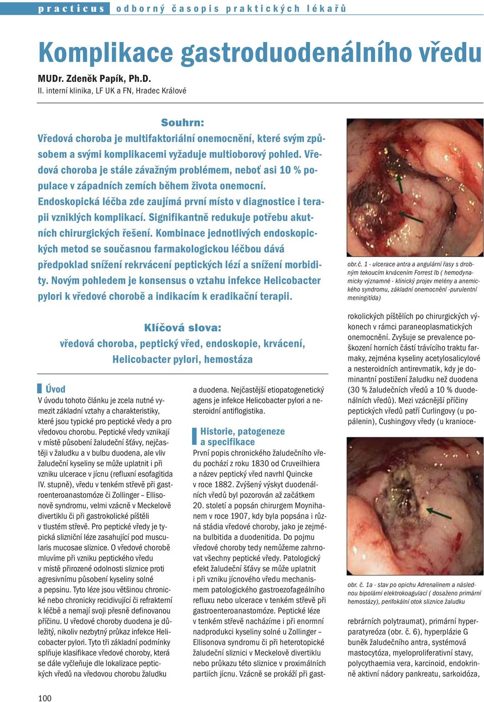 Vředová choroba je stále závažným problémem, neboť asi 10 % populace v západních zemích během života onemocní. Endoskopická léčba zde zaujímá první místo v diagnostice i terapii vzniklých komplikací.
