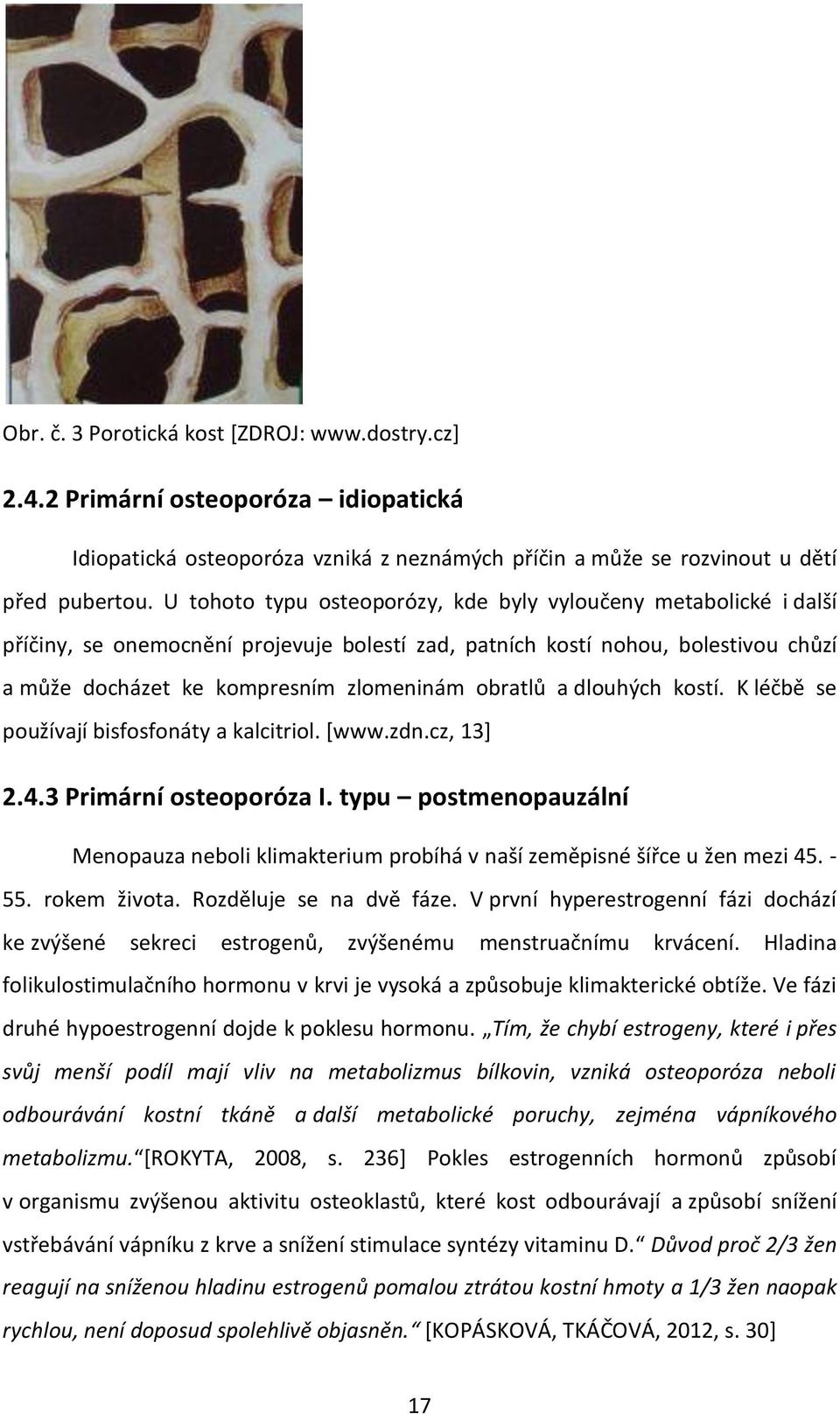 a dlouhých kostí. K léčbě se používají bisfosfonáty a kalcitriol. [www.zdn.cz, 13] 2.4.3 Primární osteoporóza I.