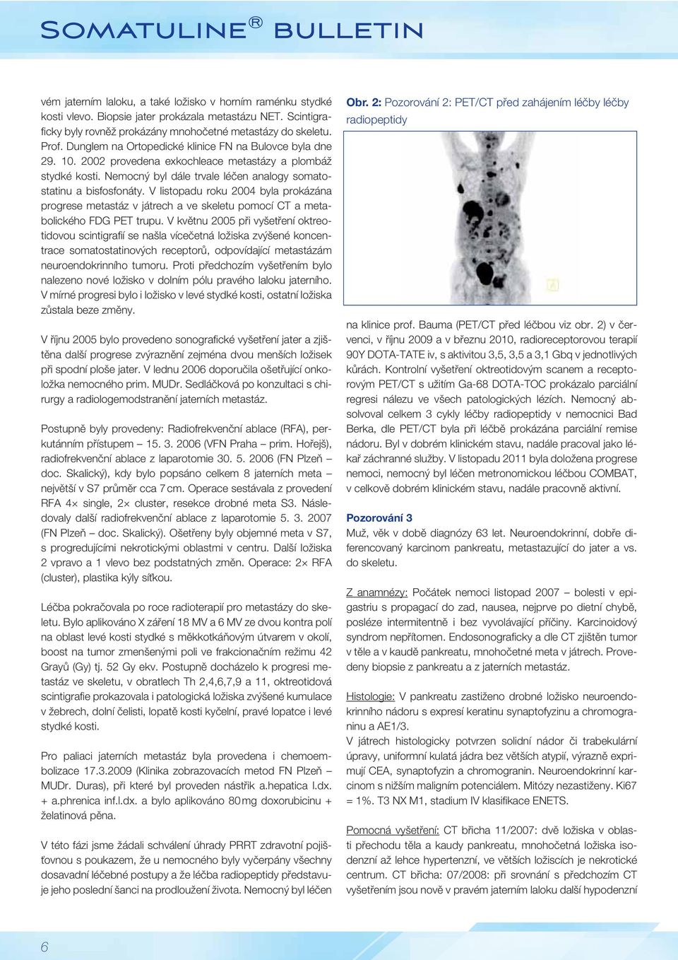 V listopadu roku 2004 byla prokázána progrese metastáz v játrech a ve skeletu pomocí CT a metabolického FDG PET trupu.