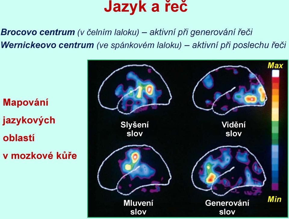 aktivní při poslechu řeči Max Mapování jazykových oblastí v