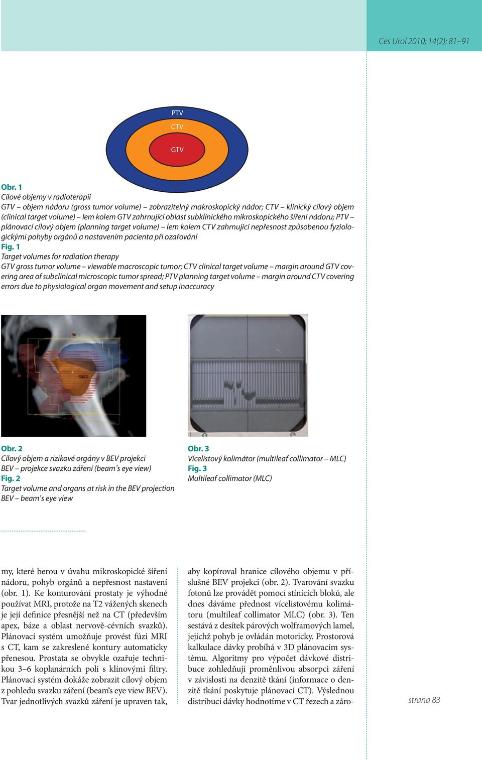 mikroskopického šíření nádoru; PTV plánovací cílový objem (planning target volume) lem kolem CTV zahrnující nepřesnost způsobenou fyziologickými pohyby orgánů a nastavením pacienta při ozařování Fig.