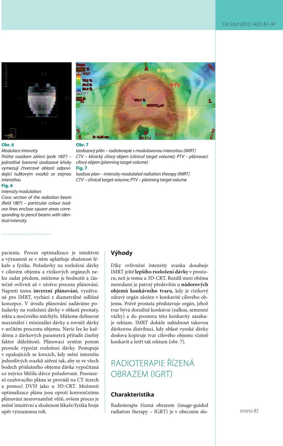 7 Izodozový plán radioterapie s modulovanou intenzitou (IMRT) CTV klinický cílový objem (clinical target volume); PTV plánovací cílový objem (planning target volume) Fig.