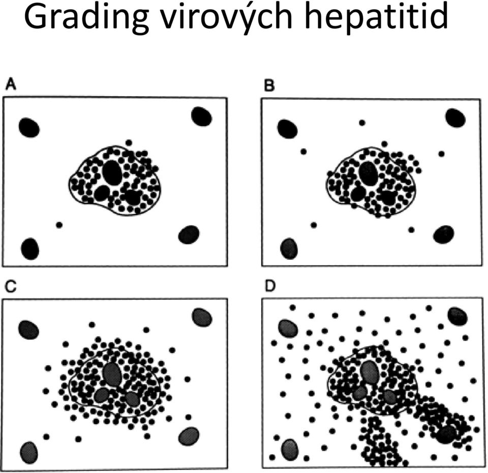 hepatitid