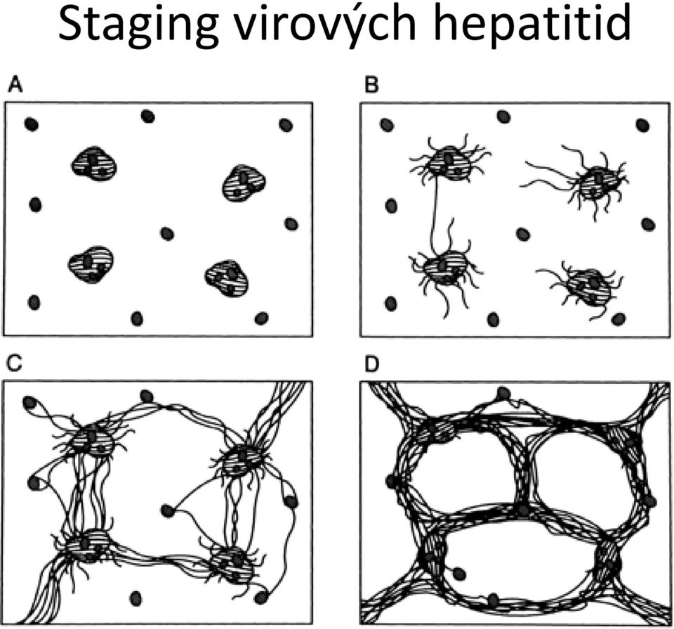 hepatitid