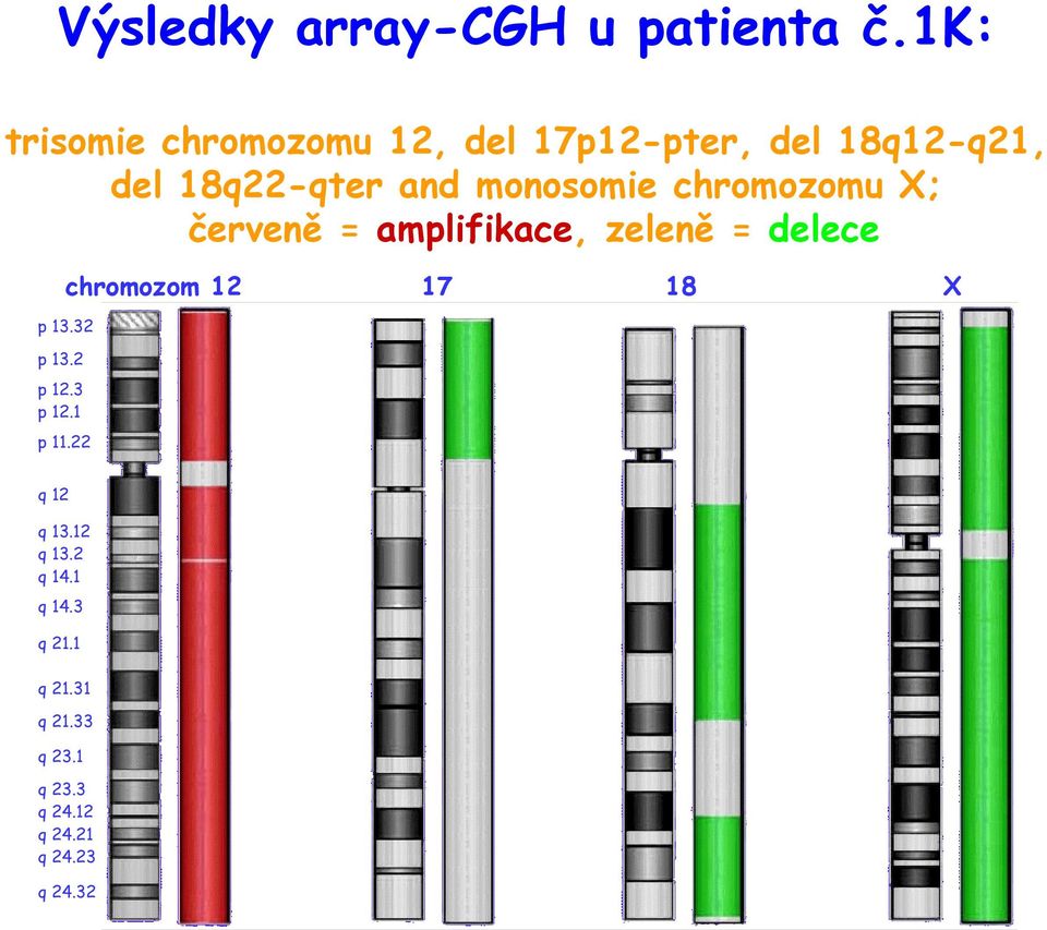 chromozom 12 17 18 X p 13.32 p 13.2 p 12.3 p 12.1 p 11.22 p 13.2 p 12 p 11.31 p 11.22 p 22.32 p 22.2 p 22.12 p 21.3 p 21.1 q 12 q 13.12 q 13.2 q 14.