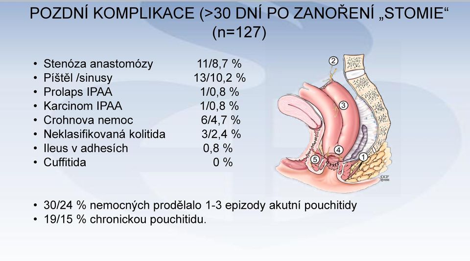 6/4,7 % Neklasifikovaná kolitida 3/2,4 % Ileus v adhesích 0,8 % Cuffitida 0 %