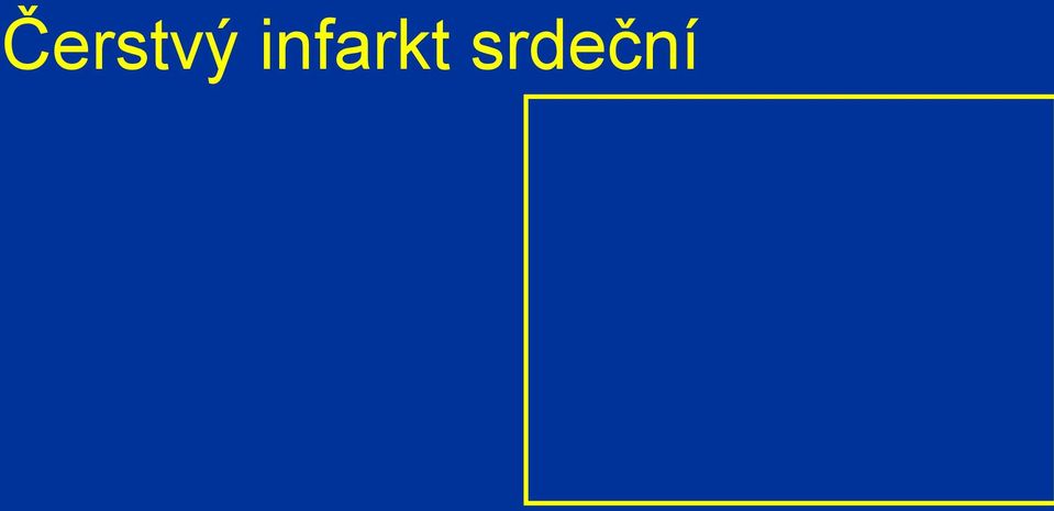 srdeční