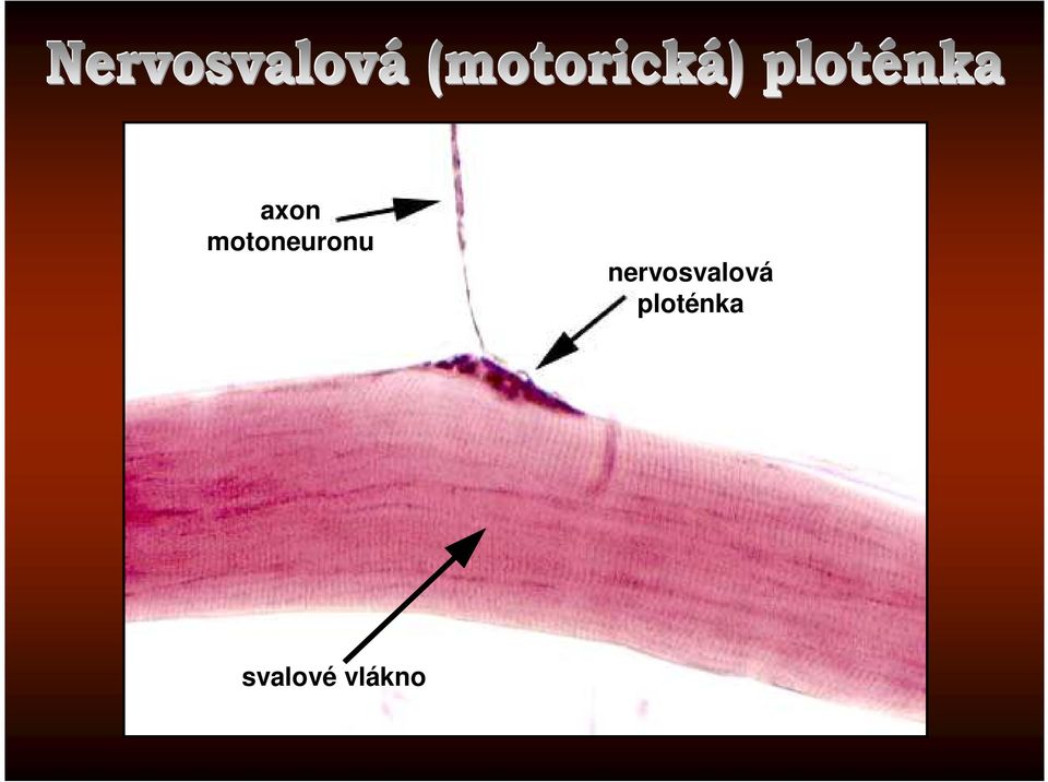 nervosvalová