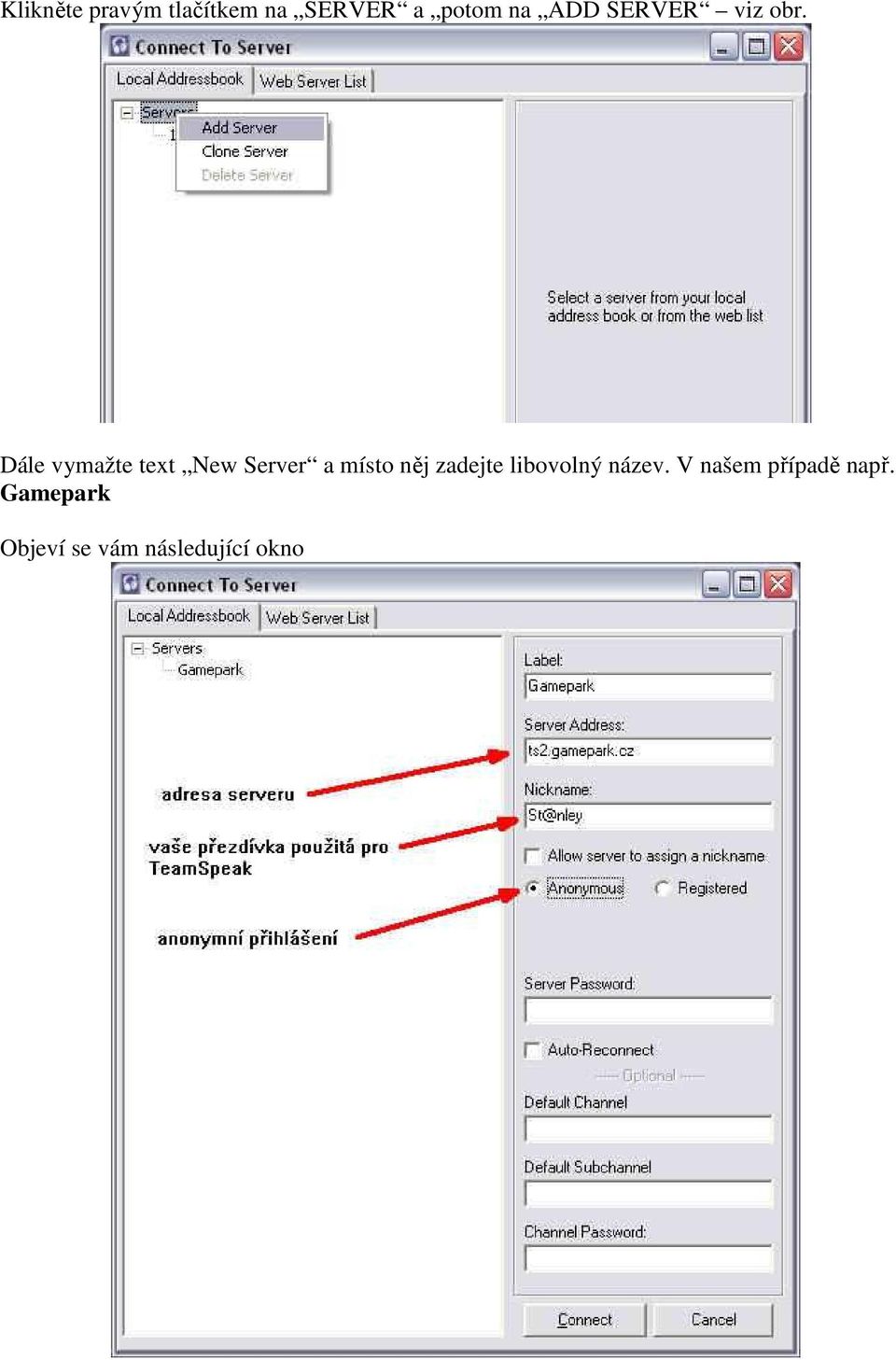 Dále vymažte text New Server a místo něj zadejte