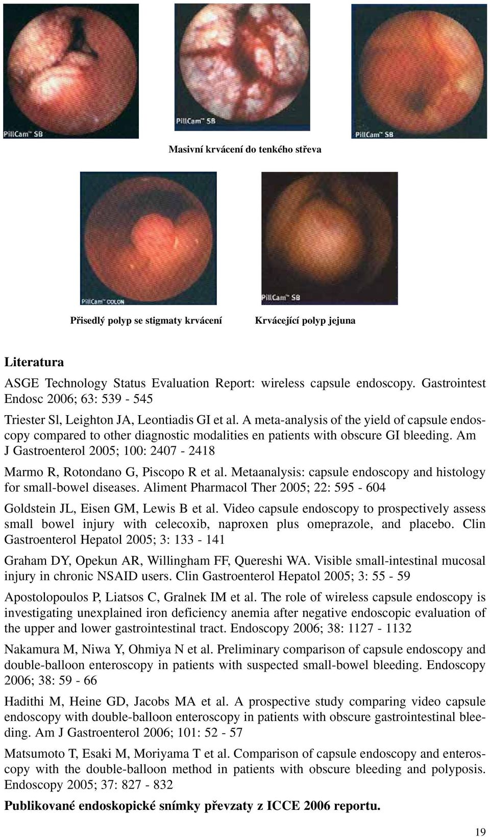 A meta-analysis of the yield of capsule endoscopy compared to other diagnostic modalities en patients with obscure GI bleeding.