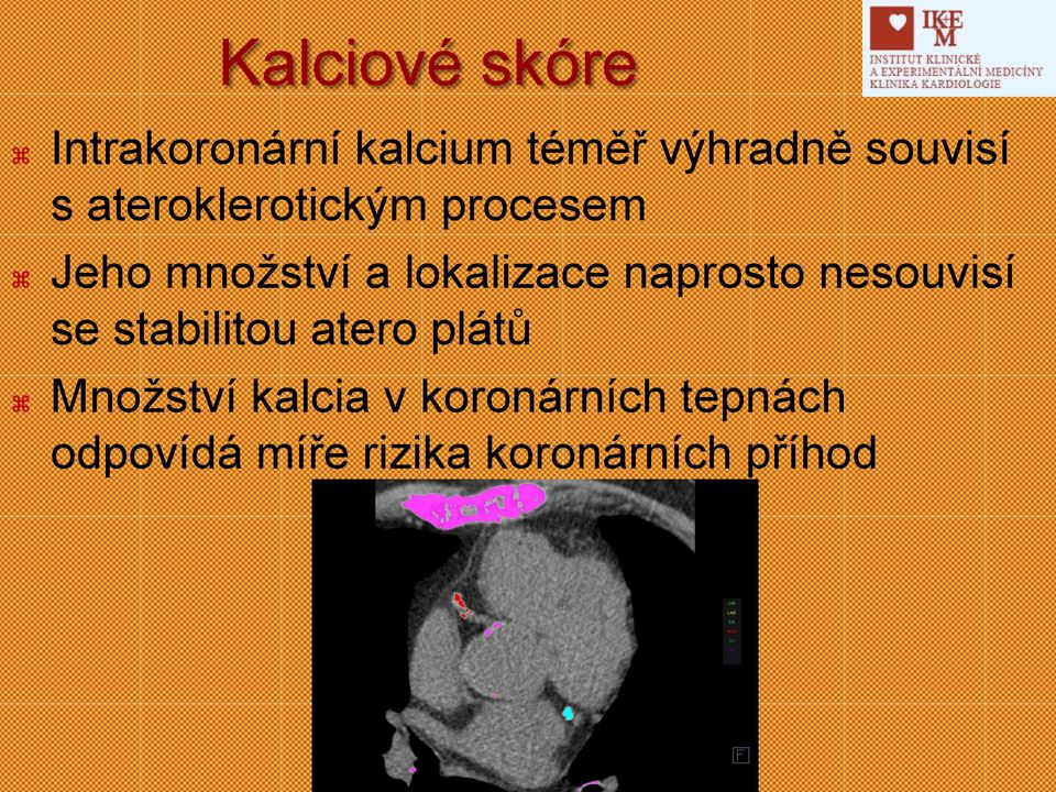 lokalizace naprosto nesouvisí se stabilitou atero plátů