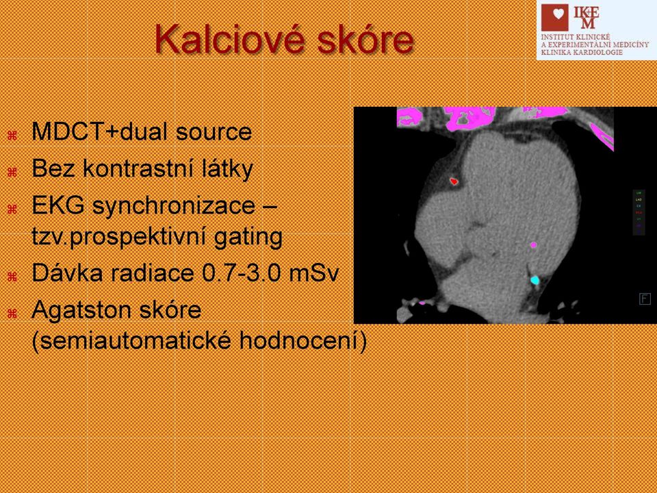 prospektivní gating Dávka radiace 0.7-3.