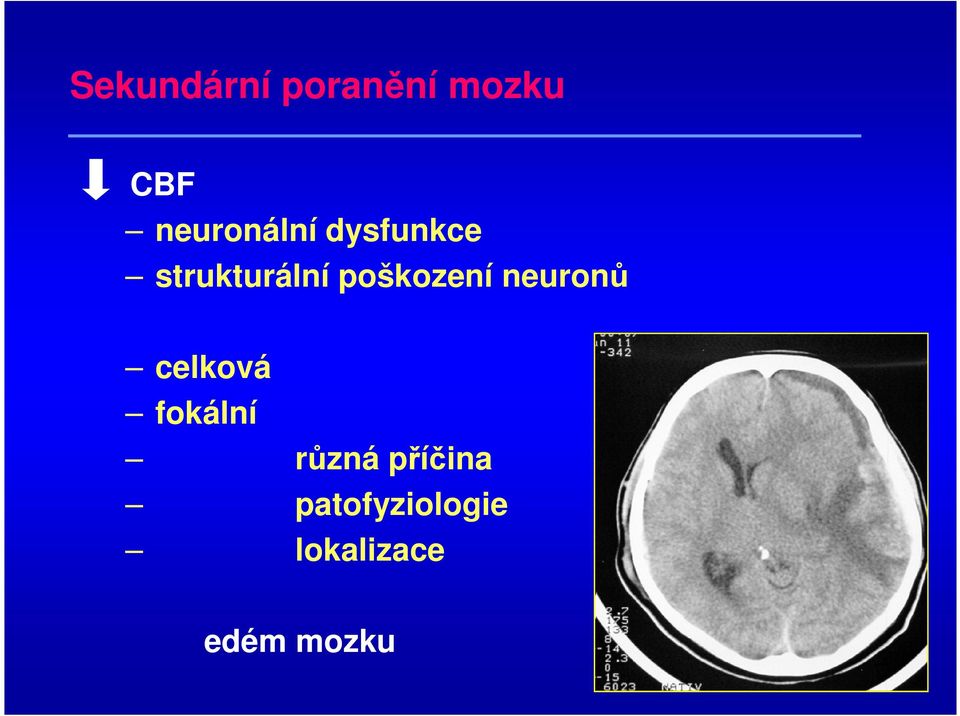 poškození neuronů celková fokální