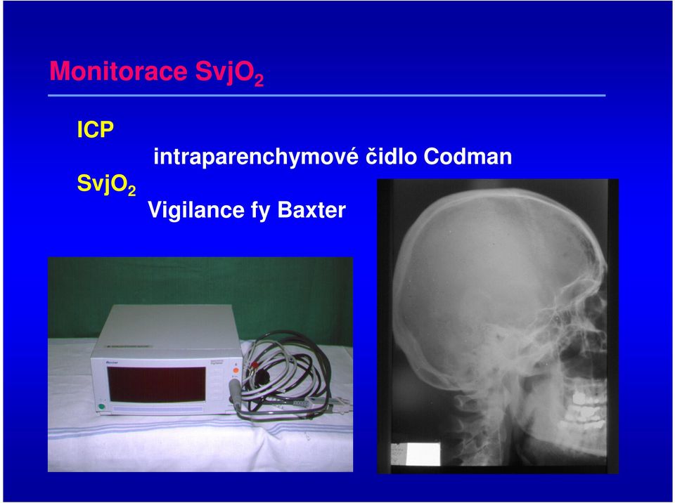 intraparenchymové