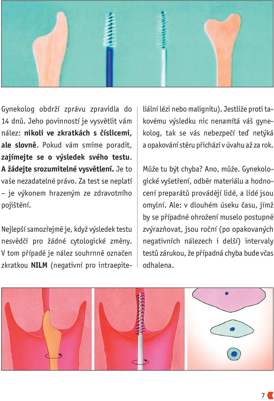 Nejlepší samozřejmě je, když výsledek testu nesvědčí pro žádné cytologické změny. V tom případě je nález souhrnně označen zkratkou NILM (negativní pro intraepite - liální lézi nebo malignitu).