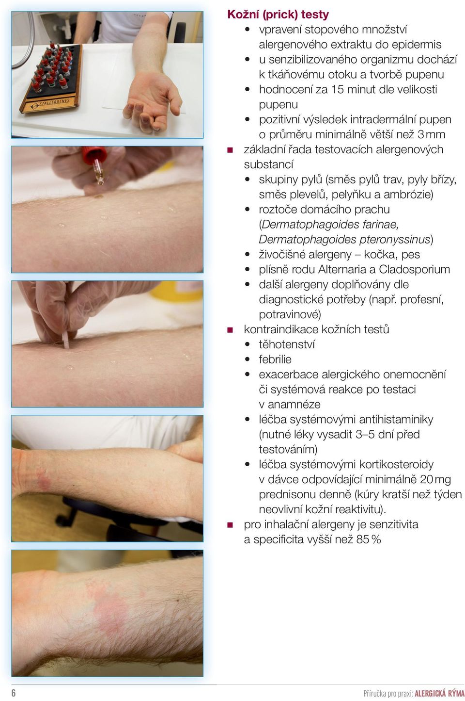 roztoče domácího prachu (Dermatophagoides farinae, Dermatophagoides pteronyssinus) živočišné alergeny kočka, pes plísně rodu Alternaria a Cladosporium další alergeny doplňovány dle diagnostické